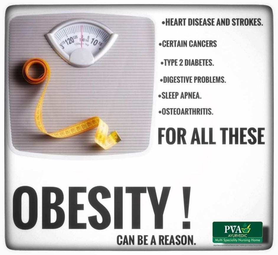 OBESITY ACCORDING TO AYURVEDA